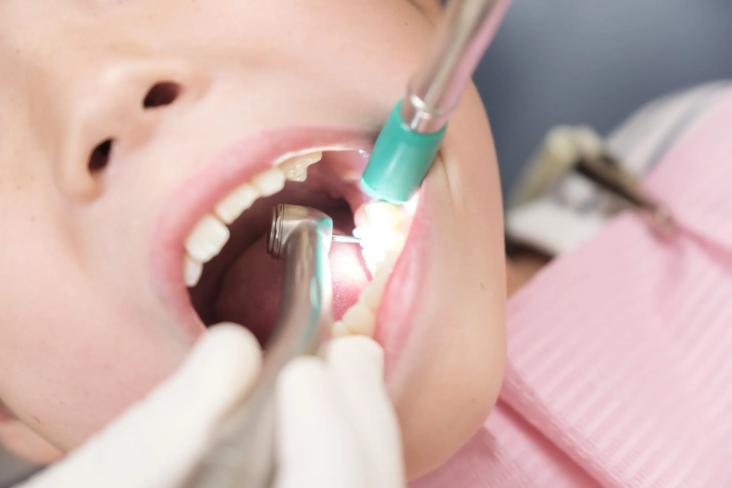 Dentist examining a patient's tooth using a dental mirror and probe during a routine oral health check-up in a modern clinic.
