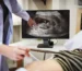 Ultrasound image showing gestational sac and yolk sac at 6 weeks pregnancy