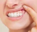 White Spots on Gums
